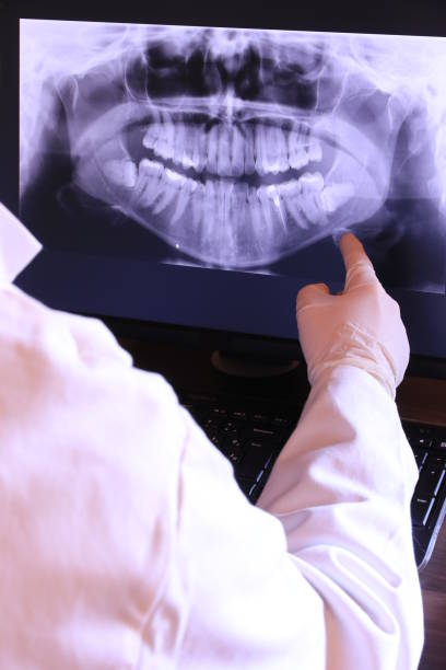 Best Root Canal Emergency Dentist  in Mazon, IL