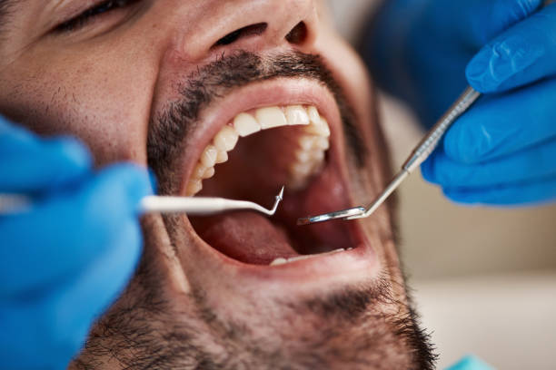 Best Broken Tooth Emergency  in Mazon, IL